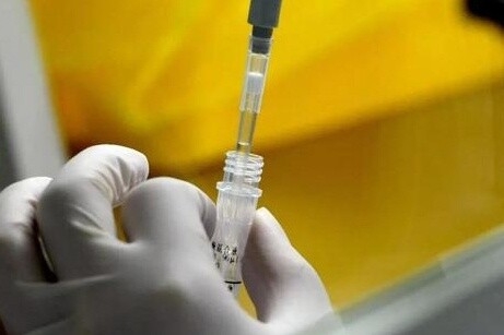 意大利研究称在去年12月口咽拭子样本中发现新冠病毒