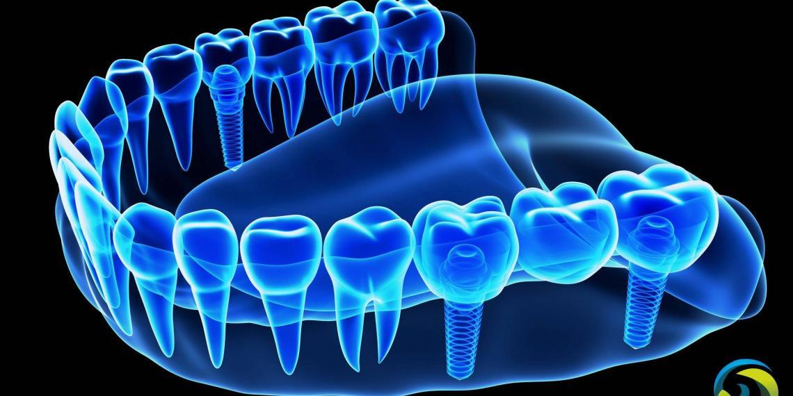 中国种植牙规模登千亿元量级 每百万人仅拥175名牙医