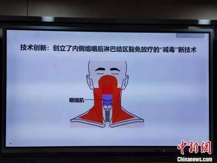 中国团队创新放疗“减毒”技术 预计使99%鼻咽癌患者受益