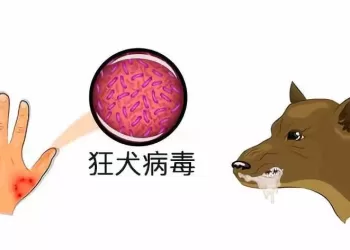 新西兰首例狂犬病病例死亡但对公众没有风险