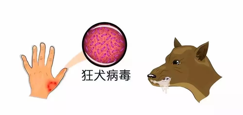 新西兰首例狂犬病病例死亡但对公众没有风险