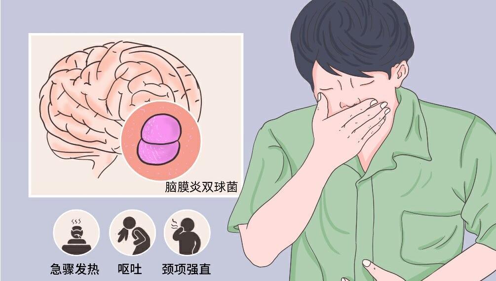 坎特伯雷学生确诊为今年第三例脑膜炎球菌病