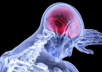 Healthcare-Stroke-Brain
