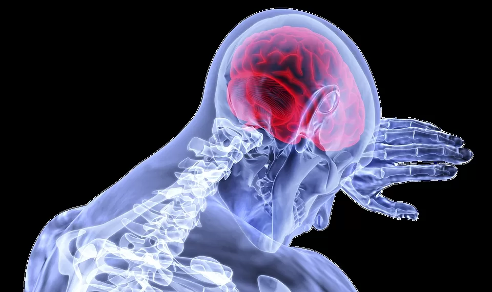 Healthcare-Stroke-Brain